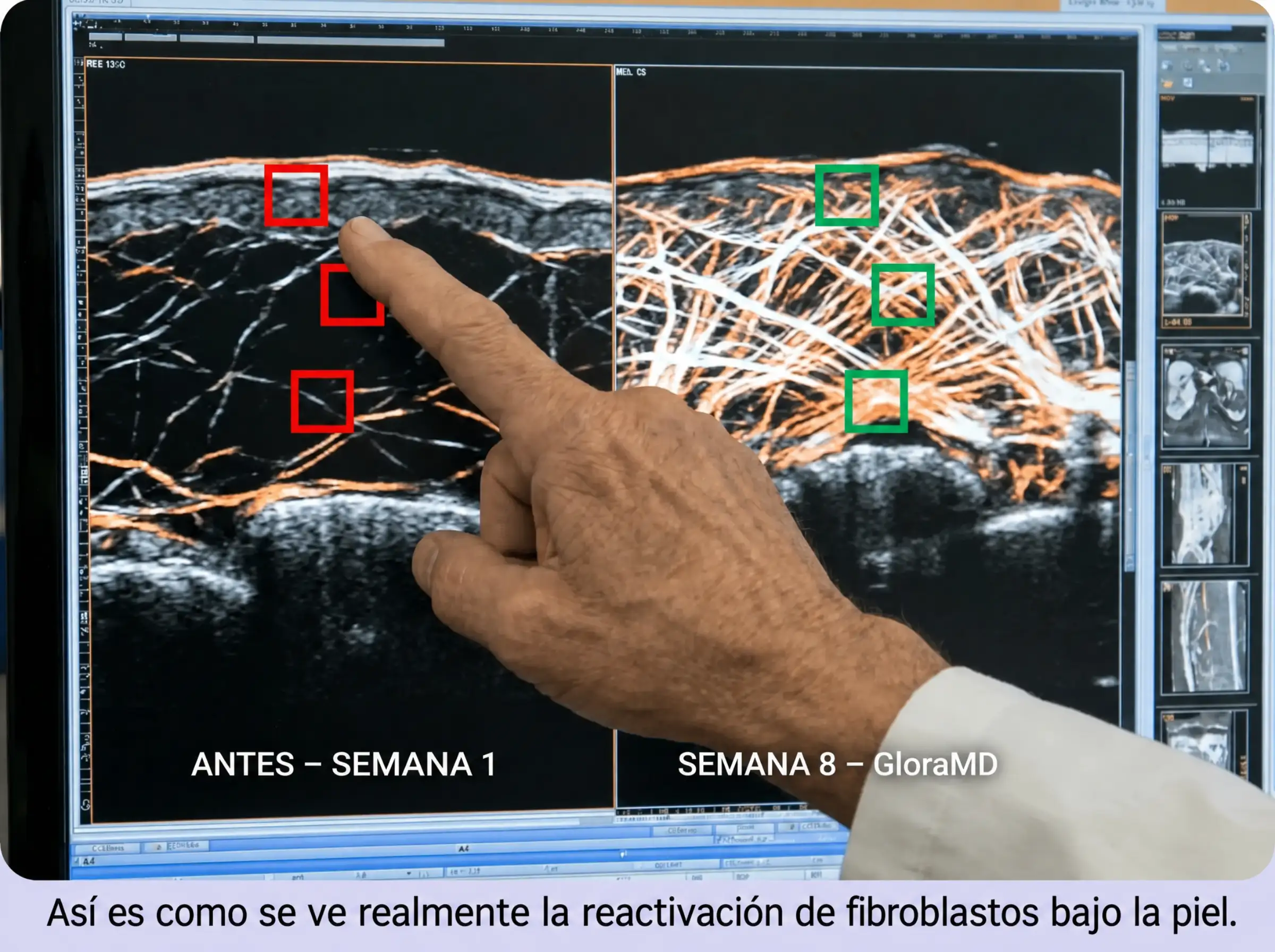 Fibroblast science